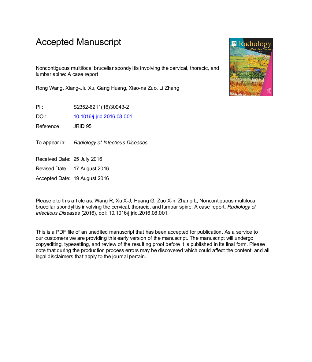 Noncontiguous multifocal brucellar spondylitis involving the cervical, thoracic, and lumbar spine: A case report