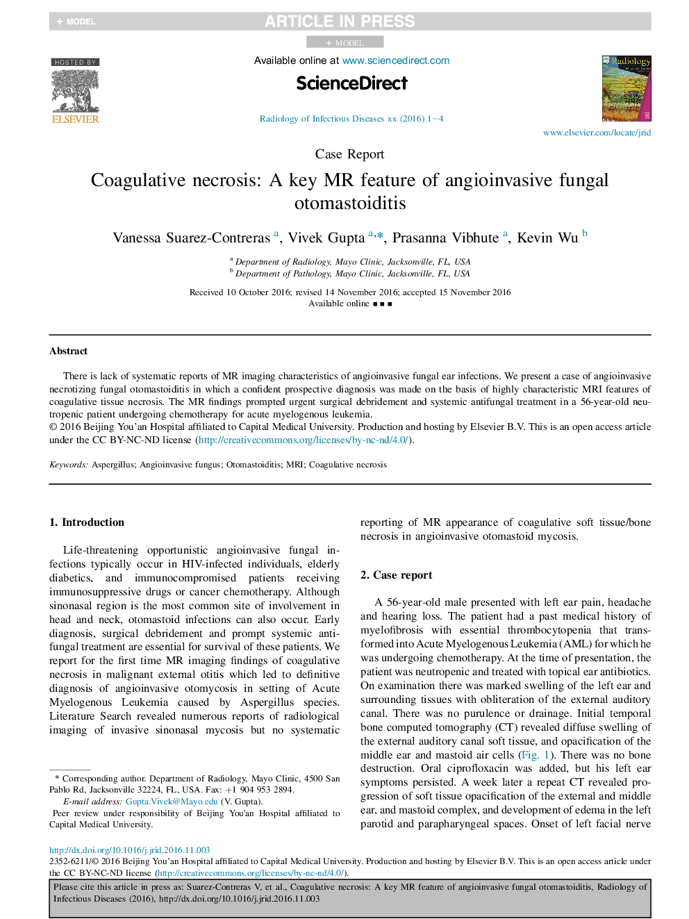 Coagulative necrosis: A key MR feature of angioinvasive fungal otomastoiditis