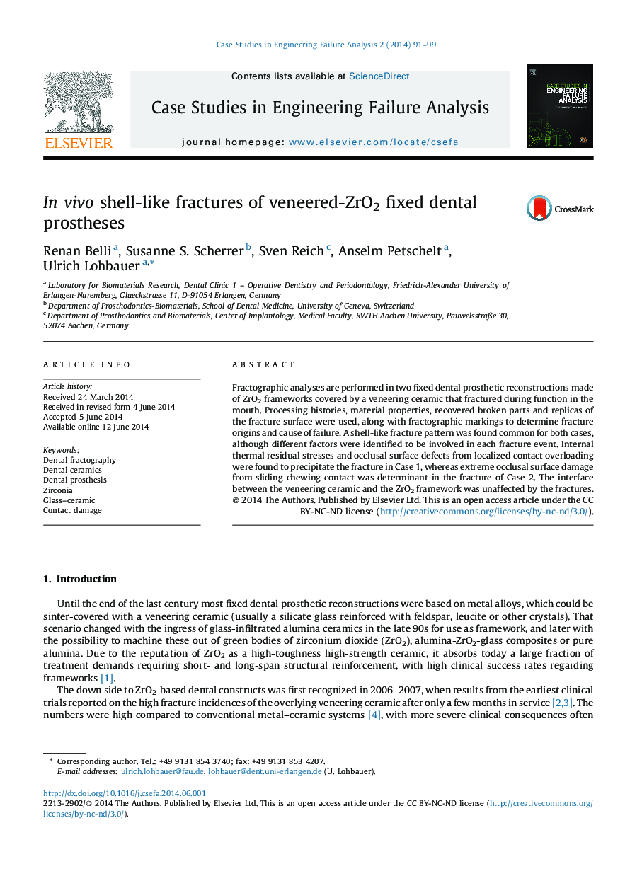 In vivo shell-like fractures of veneered-ZrO2 fixed dental prostheses