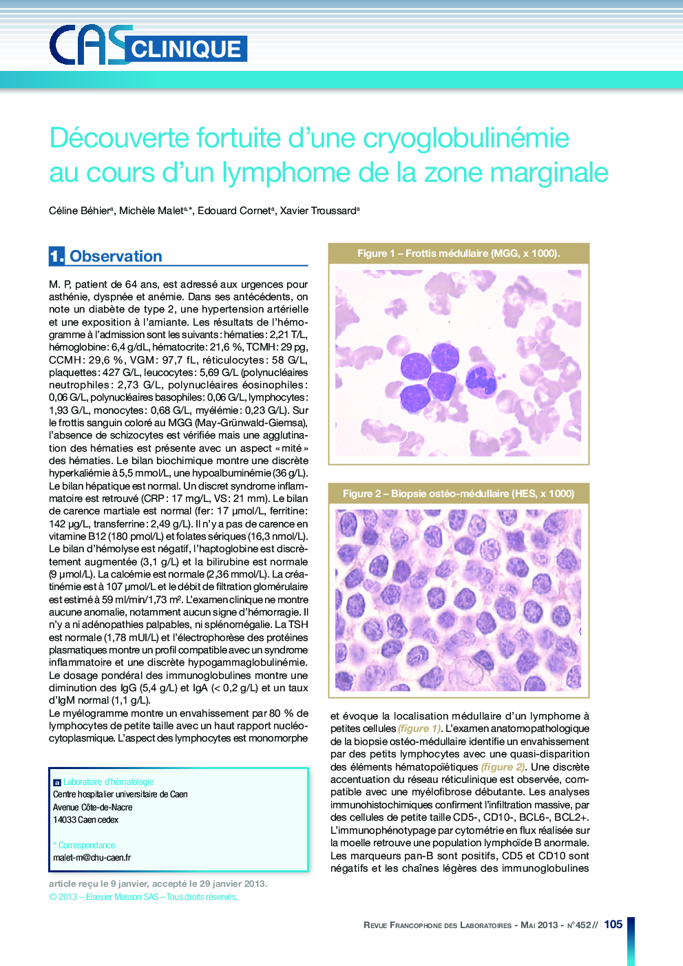 Découverte fortuite d'une cryoglobulinémie au cours d'un lymphome de la zone marginale