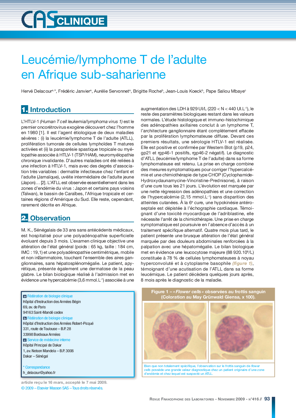 Leucémie/lymphome T de l'adulte en Afrique sub-saharienne