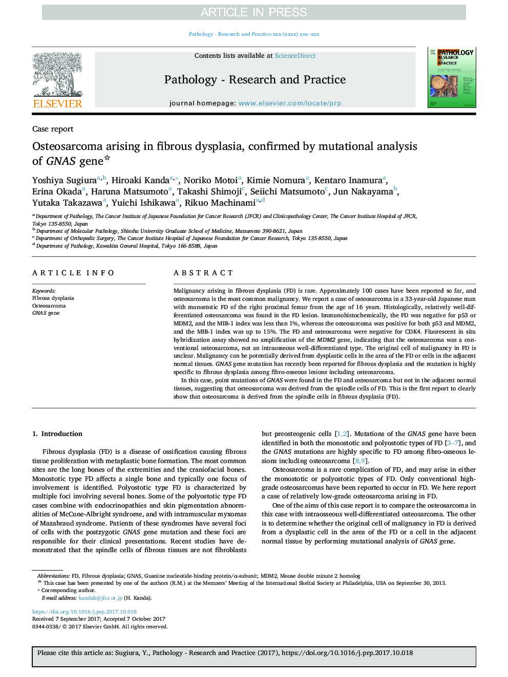 Osteosarcoma arising in fibrous dysplasia, confirmed by mutational analysis of GNAS gene