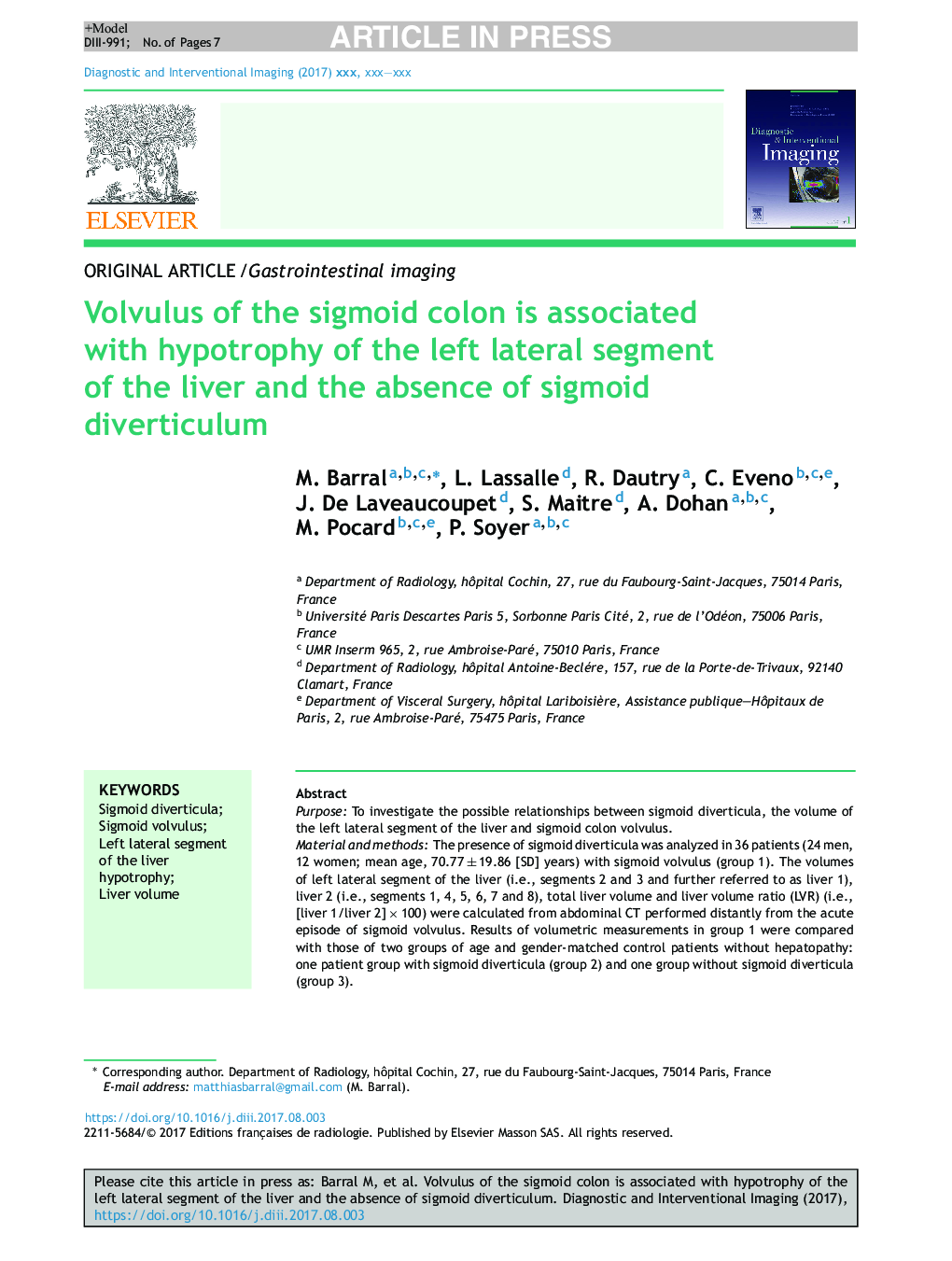 Volvulus of the sigmoid colon is associated with hypotrophy of the left lateral segment of the liver and the absence of sigmoid diverticulum