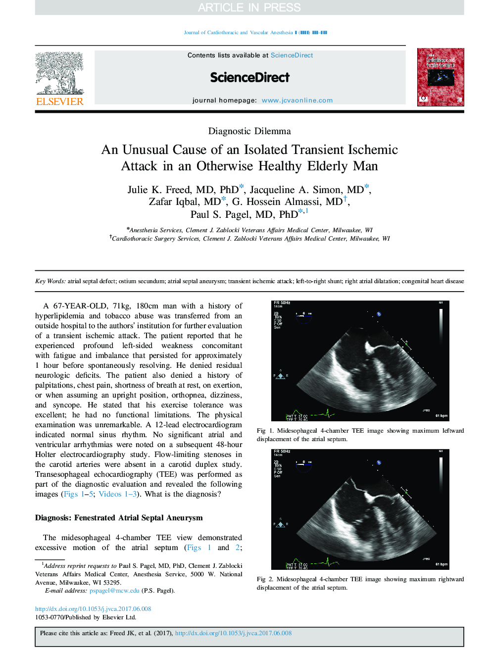 An Unusual Cause of an Isolated Transient Ischemic Attack in an Otherwise Healthy Elderly Man