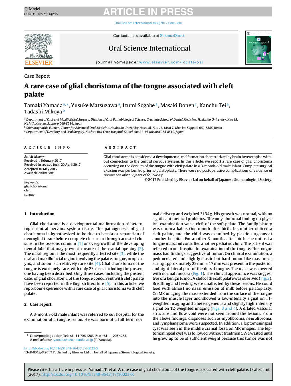 A rare case of glial choristoma of the tongue associated with cleft palate