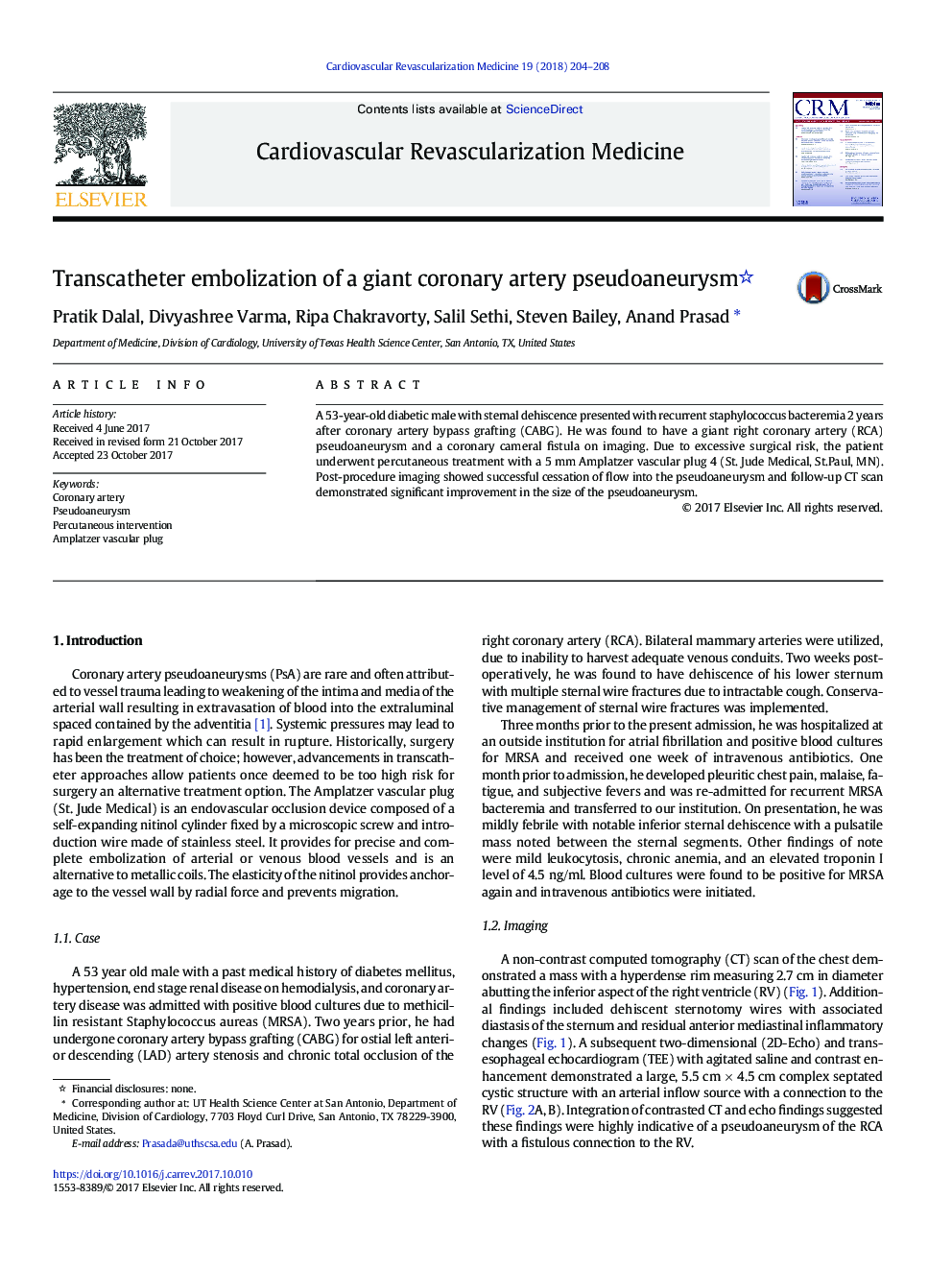 Transcatheter embolization of a giant coronary artery pseudoaneurysm