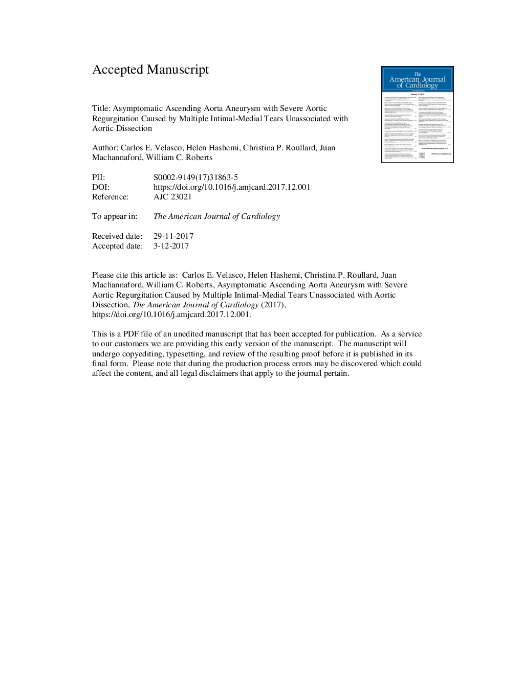 Asymptomatic Ascending Aorta Aneurysm With Severe Aortic Regurgitation Caused by Multiple Intimal-Medial Tears Unassociated With Aortic Dissection