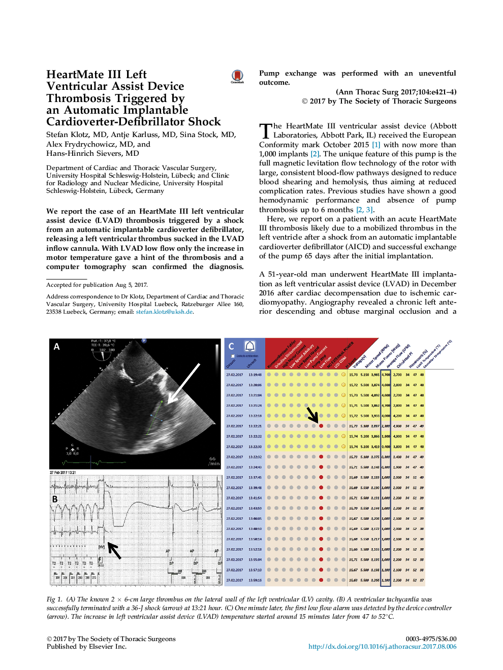 HeartMate III Left VentricularÂ Assist Device Thrombosis Triggered by anÂ Automatic Implantable Cardioverter-Defibrillator Shock