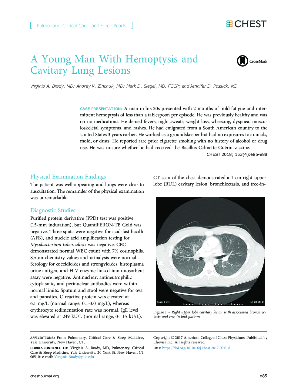 A Young Man With Hemoptysis and Cavitary Lung Lesions