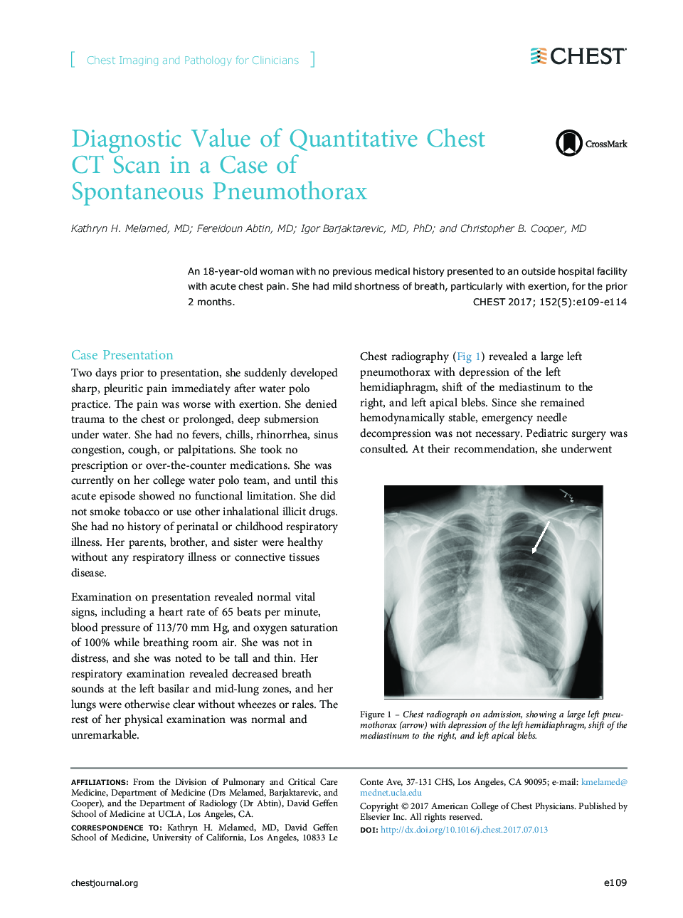 عکس صفحه اول مقاله: Diagnostic Value of Quantitative Chest CT Scan in a Case of Spontaneous Pneumothorax Diagnostic Value of Quantitative Chest CT Scan in a Case of Spontaneous Pneumothorax