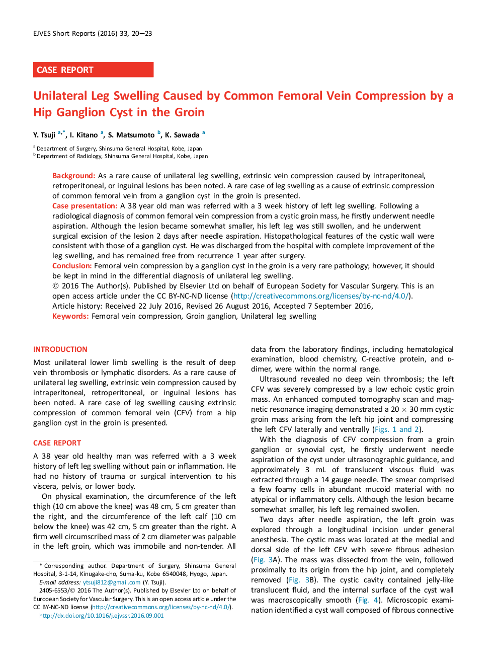 Unilateral Leg Swelling Caused by Common Femoral Vein Compression by a Hip Ganglion Cyst in the Groin