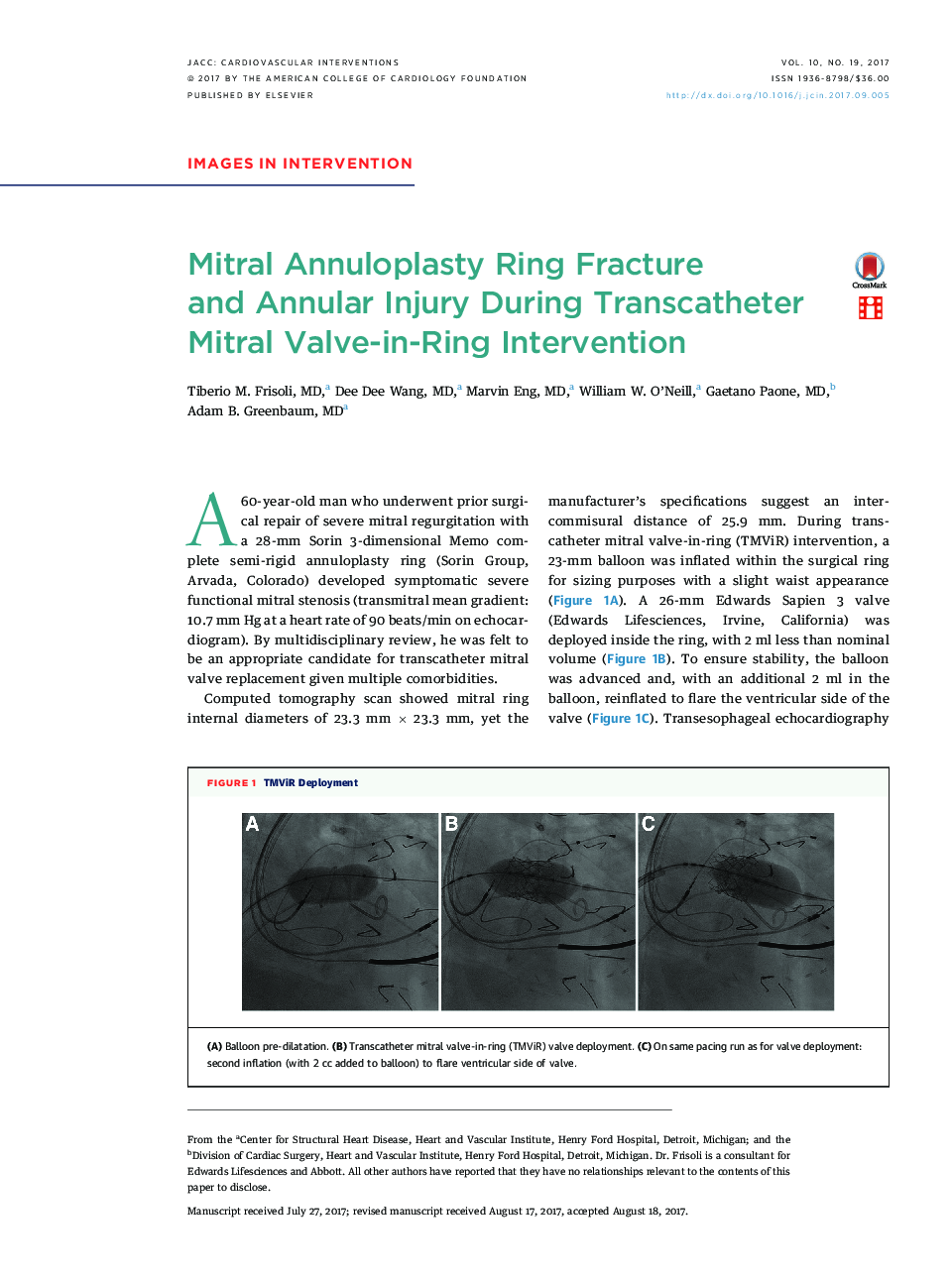 Mitral Annuloplasty Ring Fracture andÂ Annular Injury During Transcatheter Mitral Valve-in-Ring Intervention