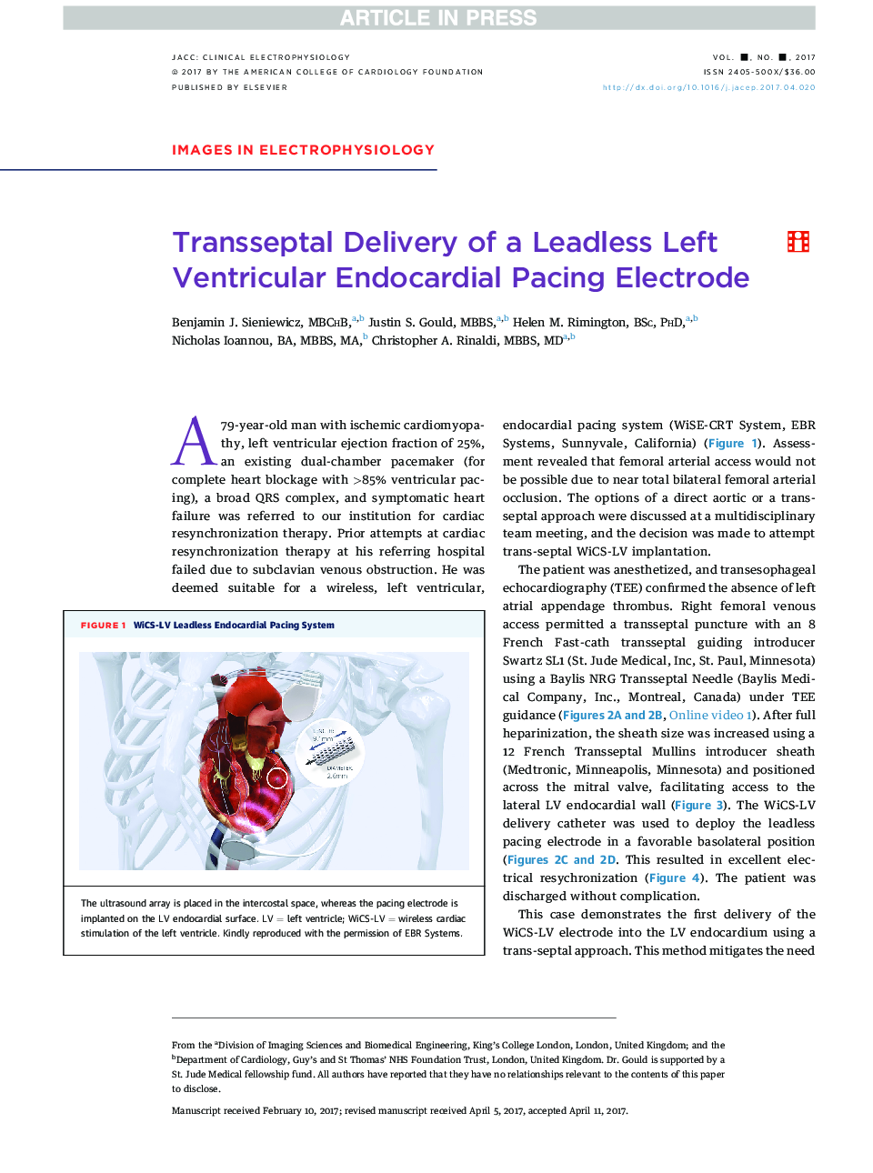 Transseptal Delivery of a Leadless Left Ventricular Endocardial Pacing Electrode