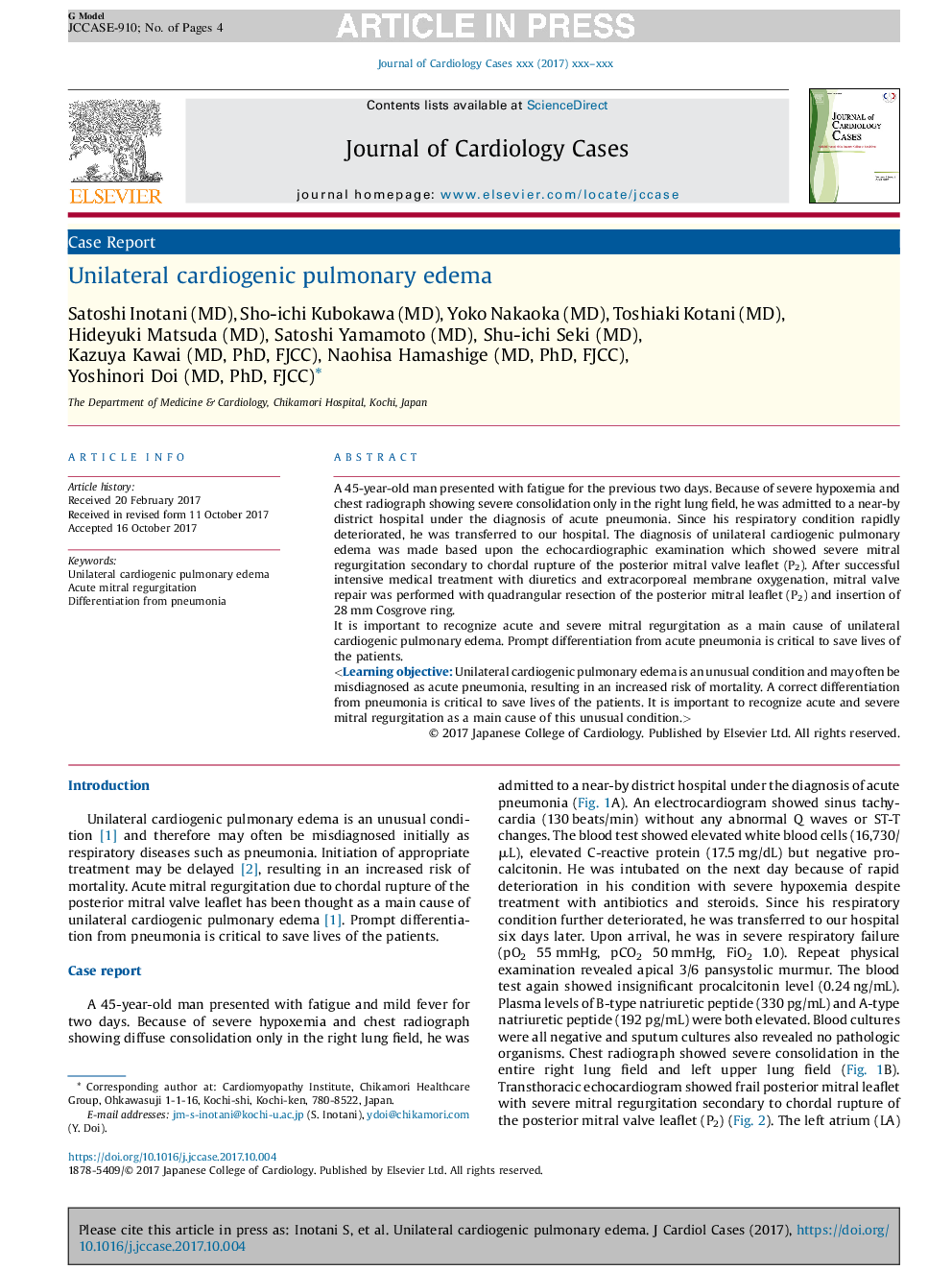 Unilateral cardiogenic pulmonary edema