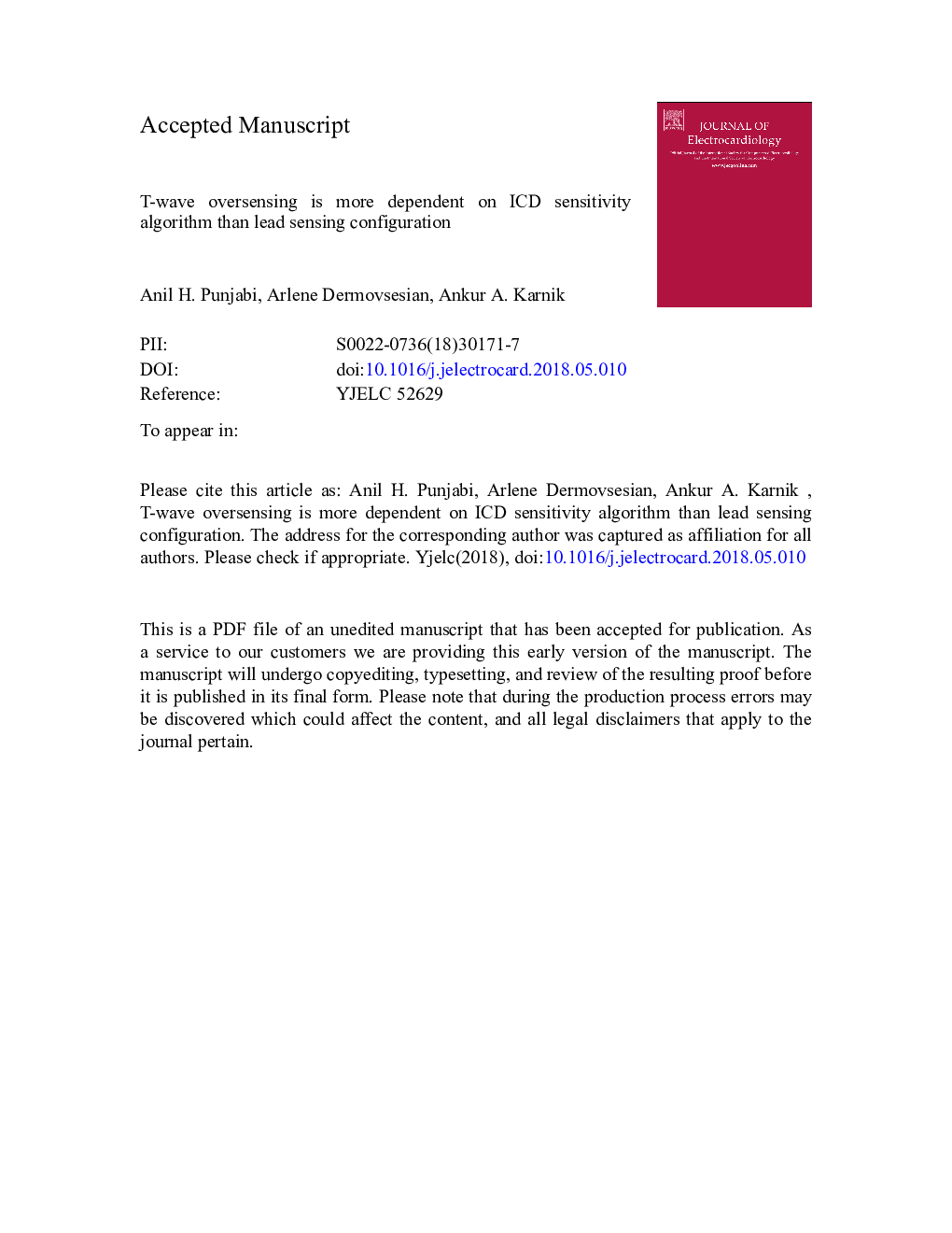 T-wave oversensing is more dependent on ICD sensitivity algorithm than lead sensing configuration