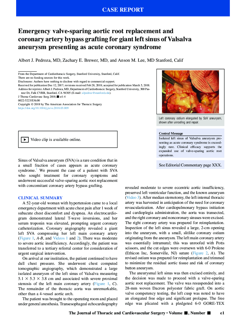 Emergency valve-sparing aortic root replacement and coronary artery bypass grafting for giant left sinus of Valsalva aneurysm presenting as acute coronary syndrome