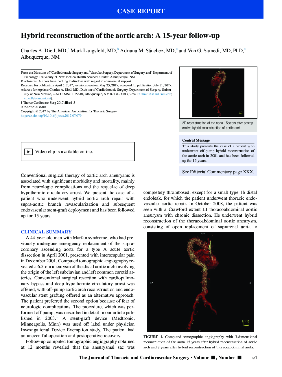 Hybrid reconstruction of the aortic arch: A 15-year follow-up