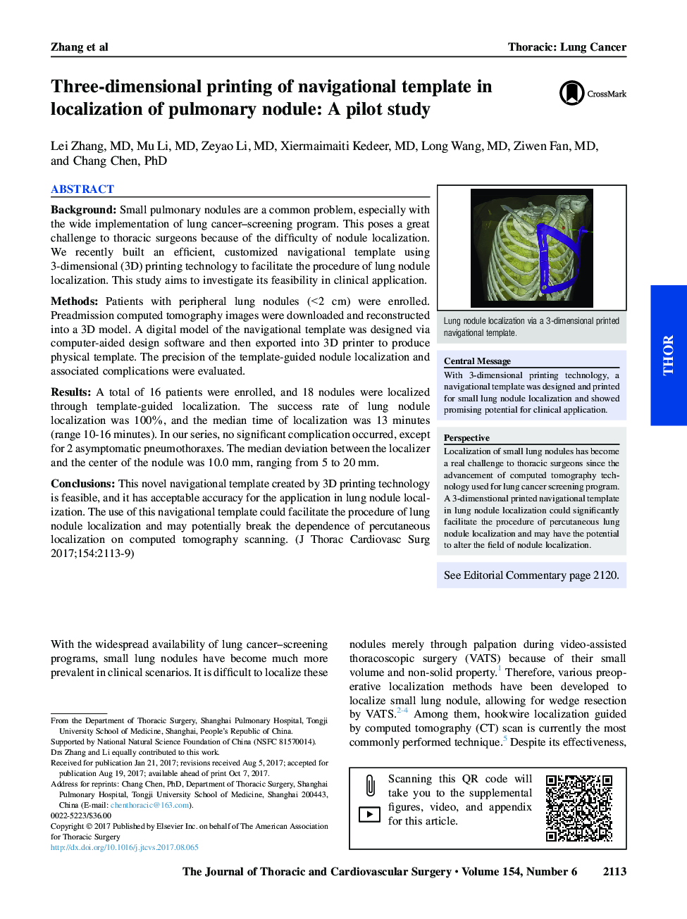 Three-dimensional printing of navigational template in localization of pulmonary nodule: A pilot study