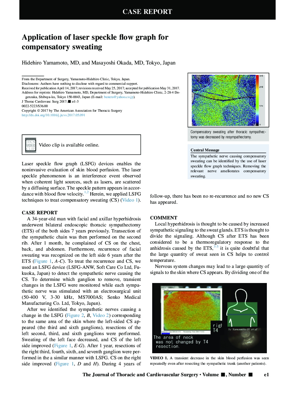 Application of laser speckle flow graph for compensatory sweating