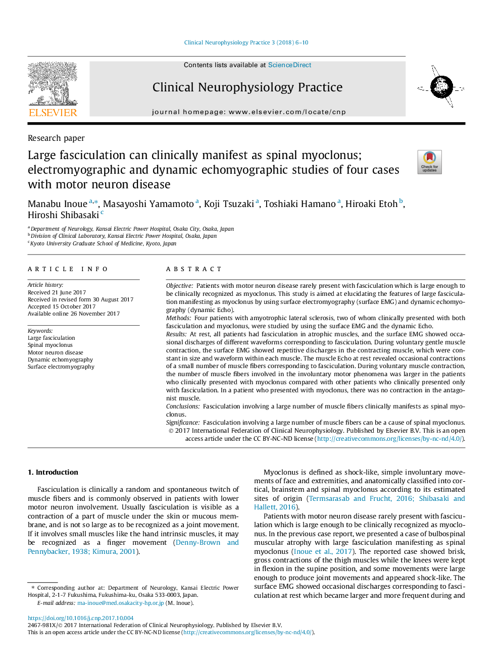 Large fasciculation can clinically manifest as spinal myoclonus; electromyographic and dynamic echomyographic studies of four cases with motor neuron disease