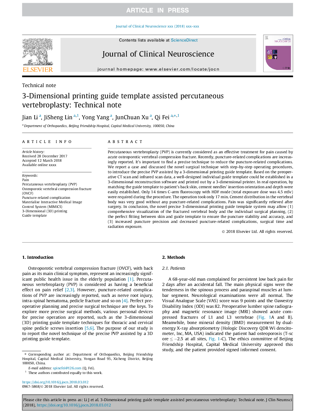 3-Dimensional printing guide template assisted percutaneous vertebroplasty: Technical note