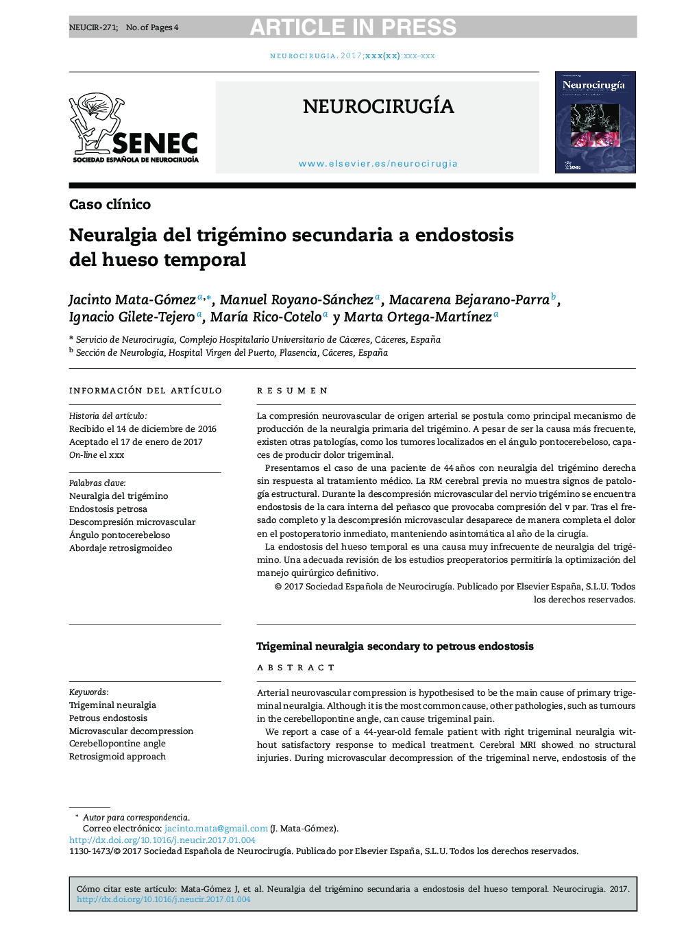 Neuralgia del trigémino secundaria a endostosis del hueso temporal