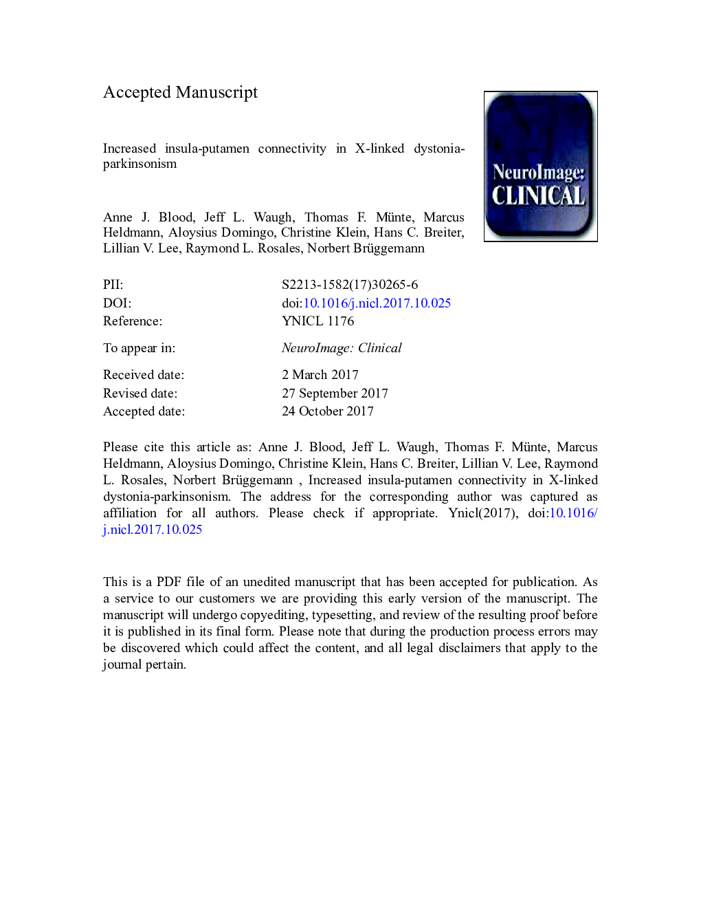 Increased insula-putamen connectivity in X-linked dystonia-parkinsonism