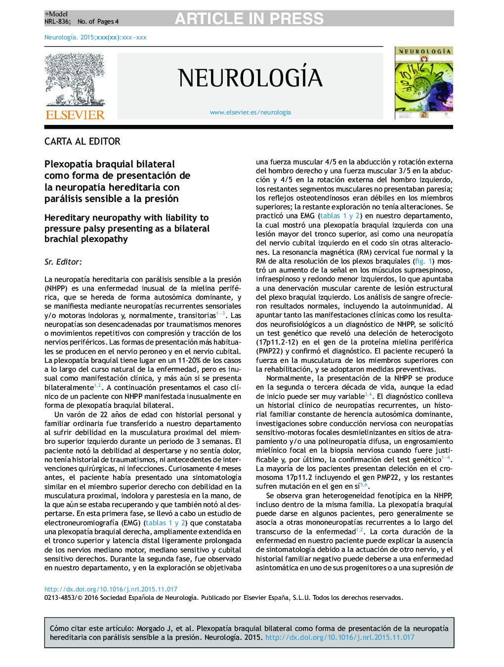 PlexopatÃ­a braquial bilateral como forma de presentación de la neuropatÃ­a hereditaria con parálisis sensible a la presión
