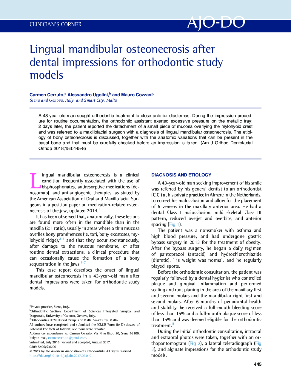 Lingual mandibular osteonecrosis after dental impressions for orthodontic study models