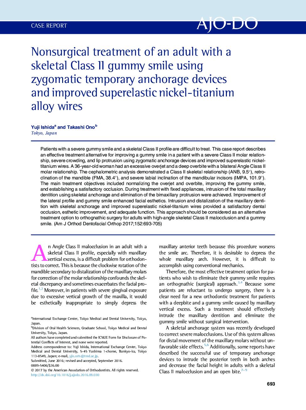 Nonsurgical treatment of an adult with a skeletal Class II gummy smile using zygomatic temporary anchorage devices and improved superelastic nickel-titanium alloy wires