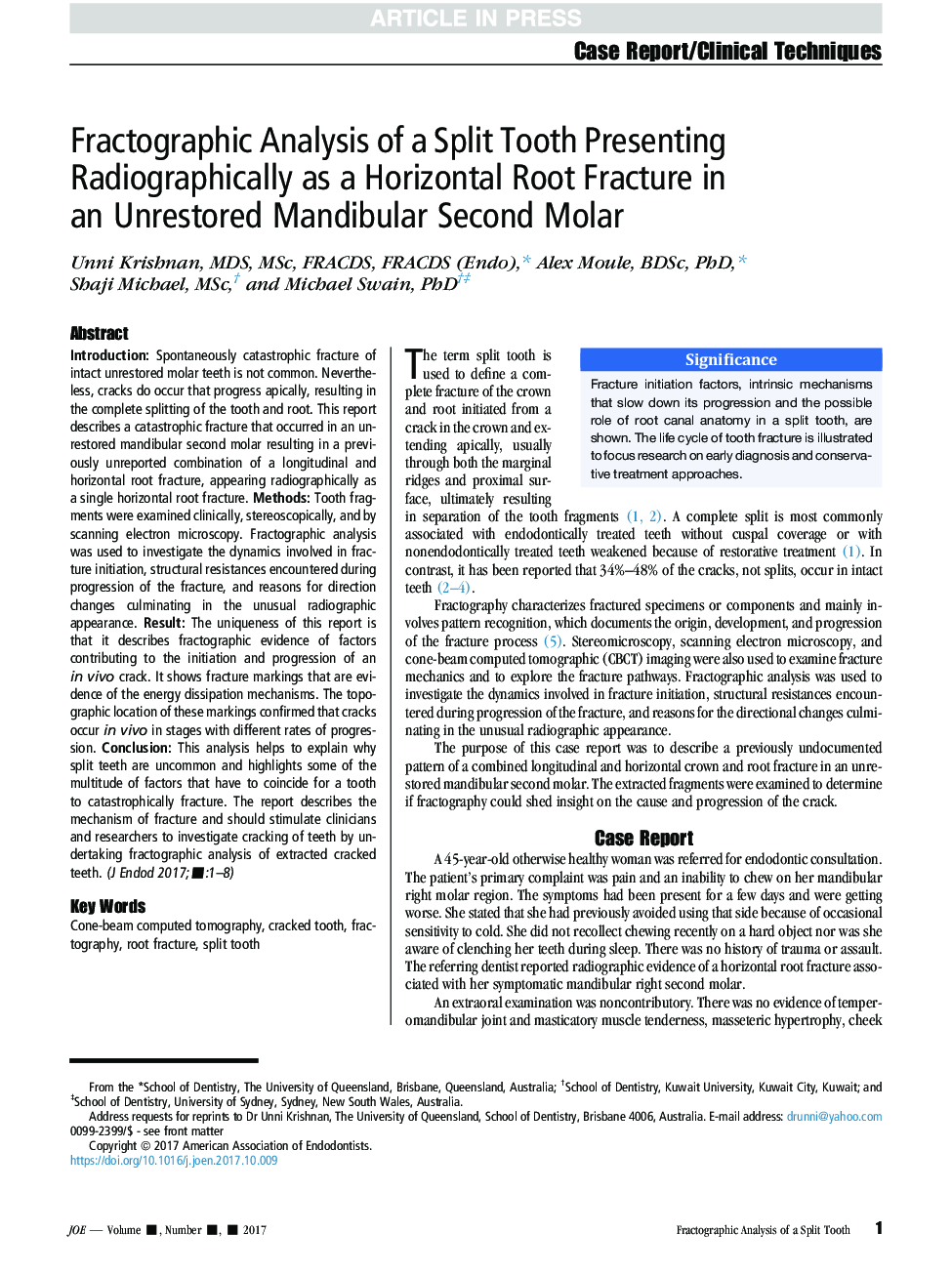 Fractographic Analysis of a Split Tooth Presenting Radiographically as a Horizontal Root Fracture in an Unrestored Mandibular SecondÂ Molar