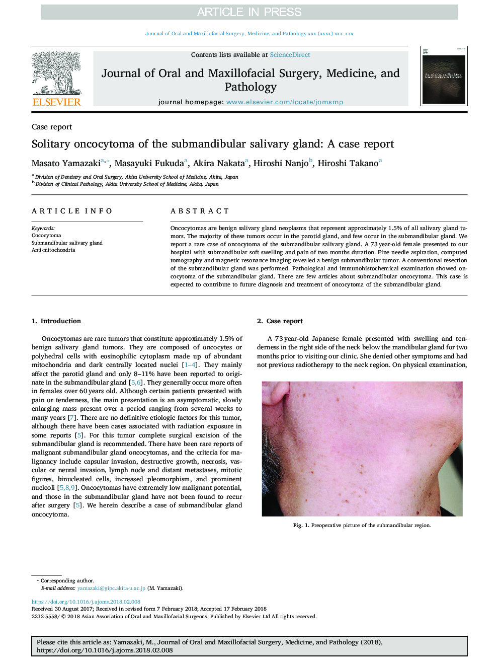 Solitary oncocytoma of the submandibular salivary gland: A case report
