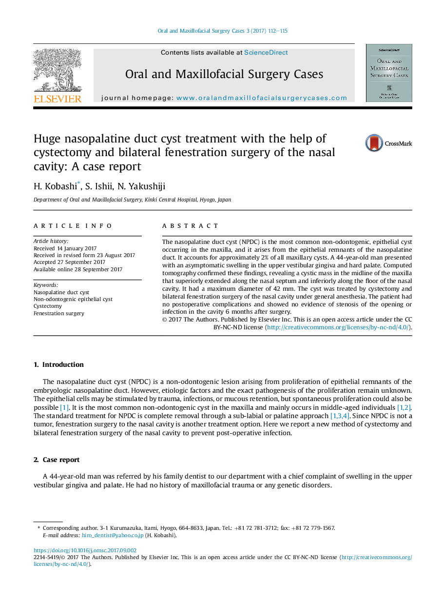 Huge nasopalatine duct cyst treatment with the help of cystectomy and bilateral fenestration surgery of the nasal cavity: A case report