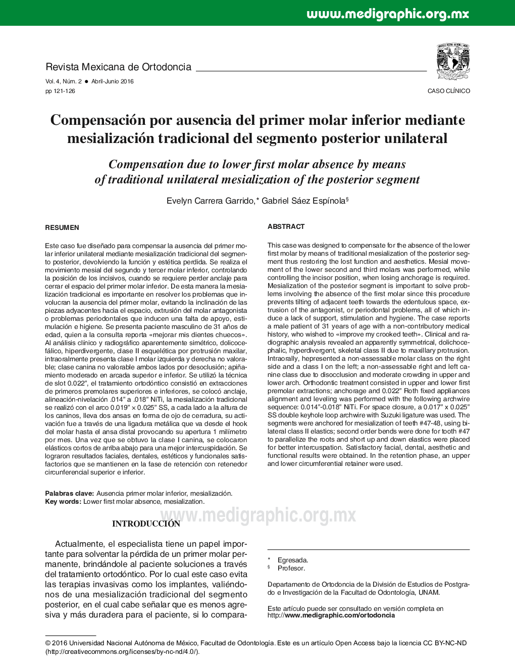 Compensación por ausencia del primer molar inferior mediante mesialización tradicional del segmento posterior unilateral