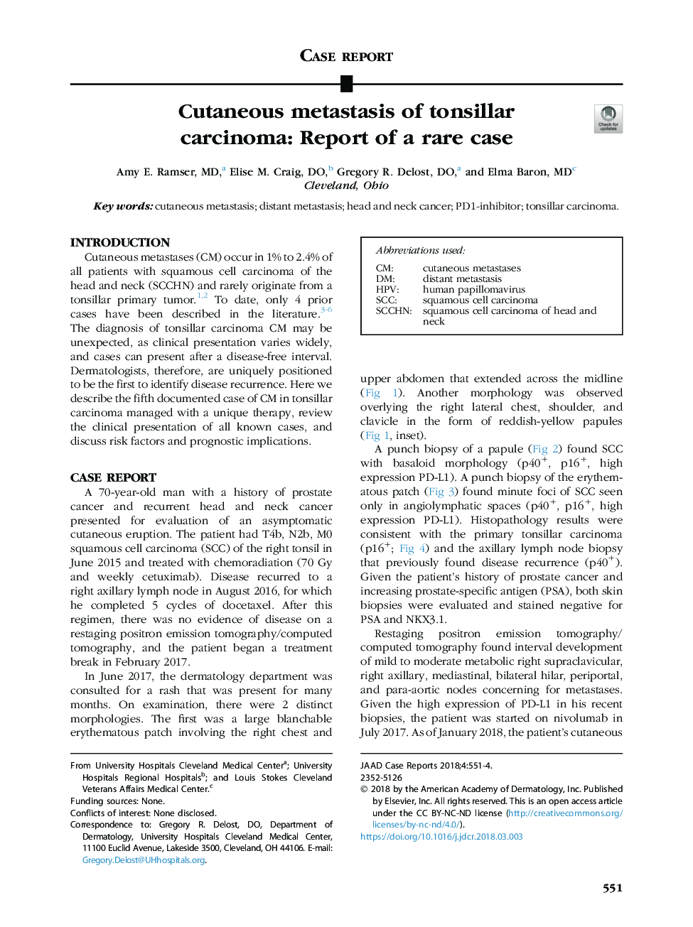 متاستاز پوستی کارسینوم تنسیلی: گزارش یک مورد نادر 