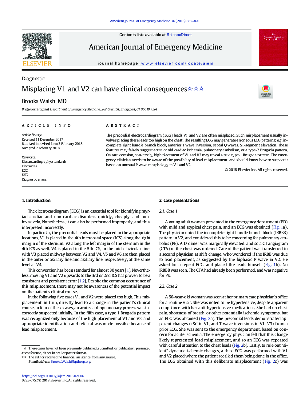 Misplacing V1 and V2 can have clinical consequences