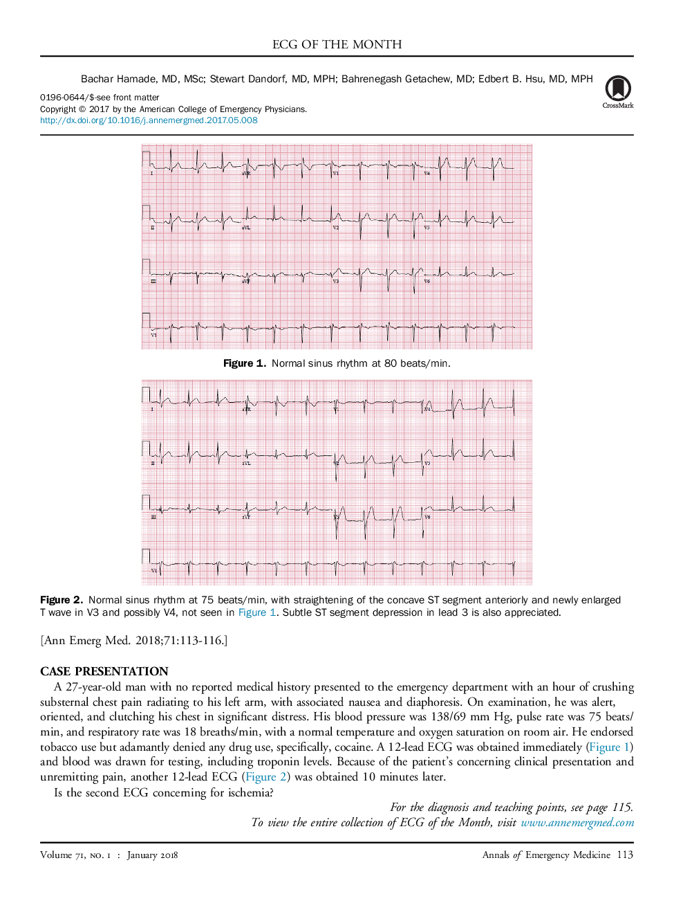 Young Male With Chest Pain