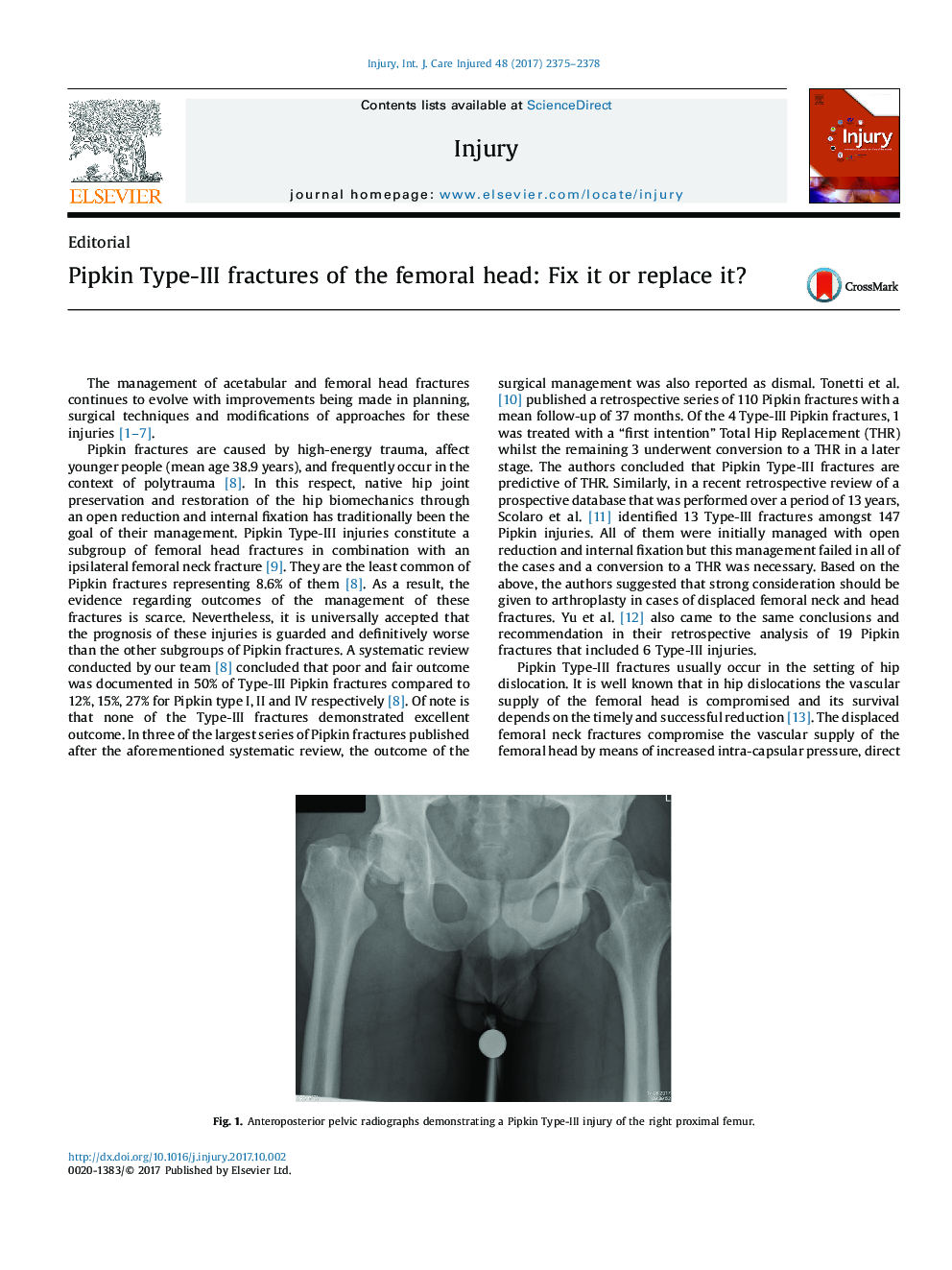 Pipkin Type-III fractures of the femoral head: Fix it or replace it?