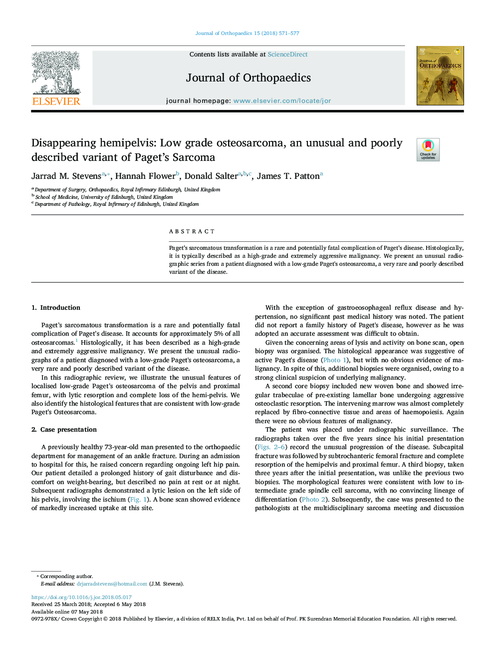 Disappearing hemipelvis: Low grade osteosarcoma, an unusual and poorly described variant of Paget's Sarcoma