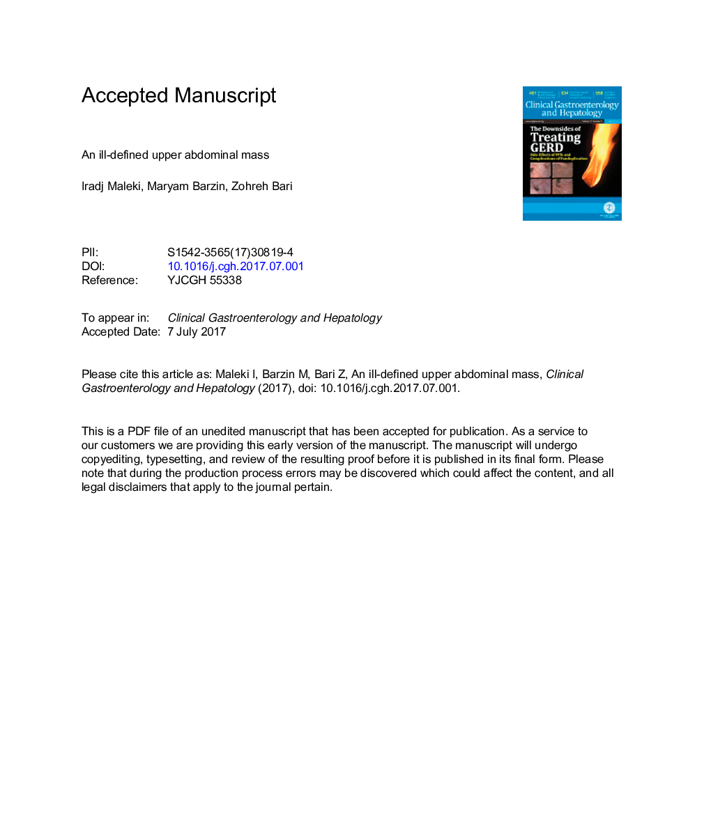 An Ill-Defined Upper Abdominal Mass