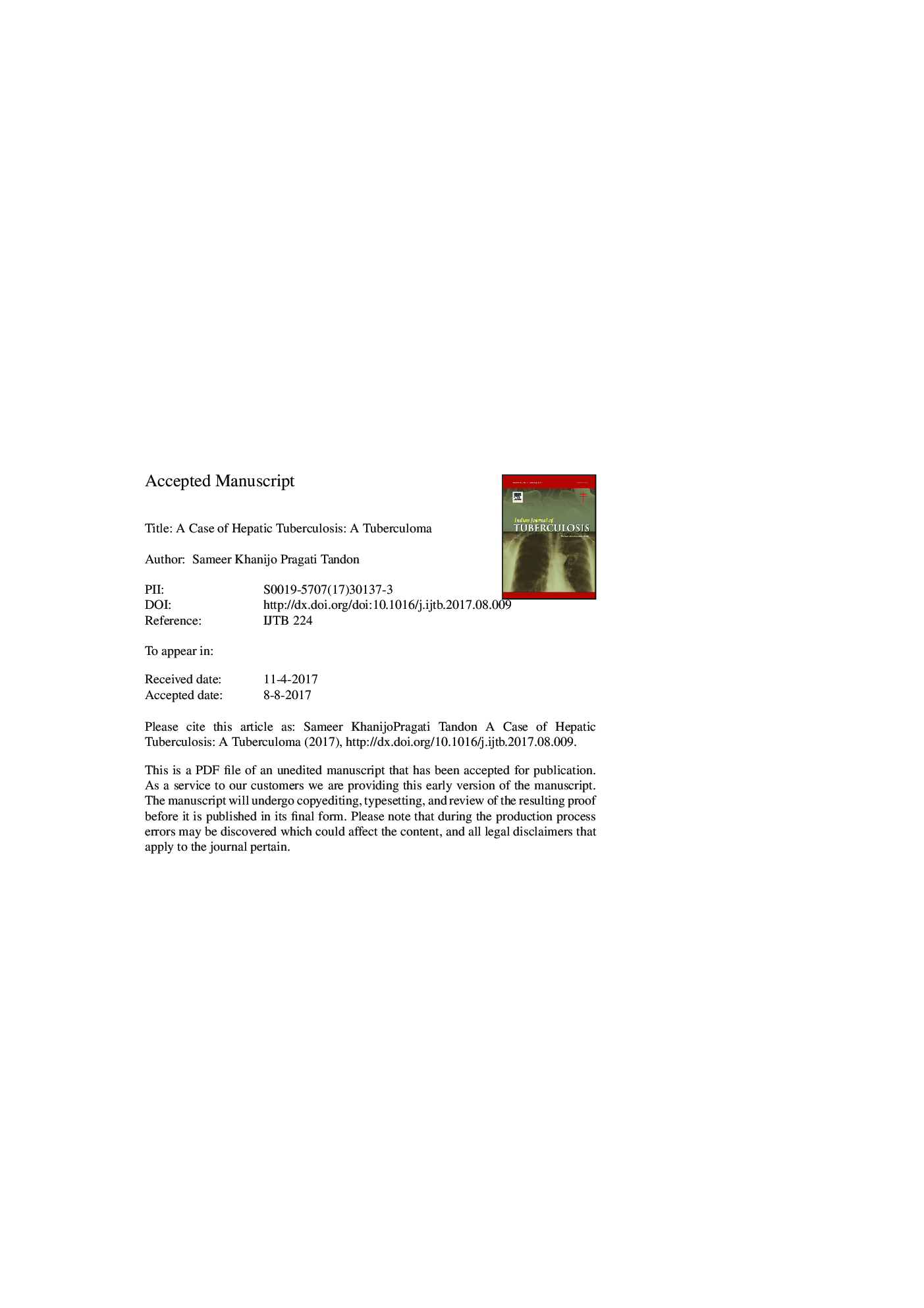 A case of hepatic tuberculosis: A tuberculoma