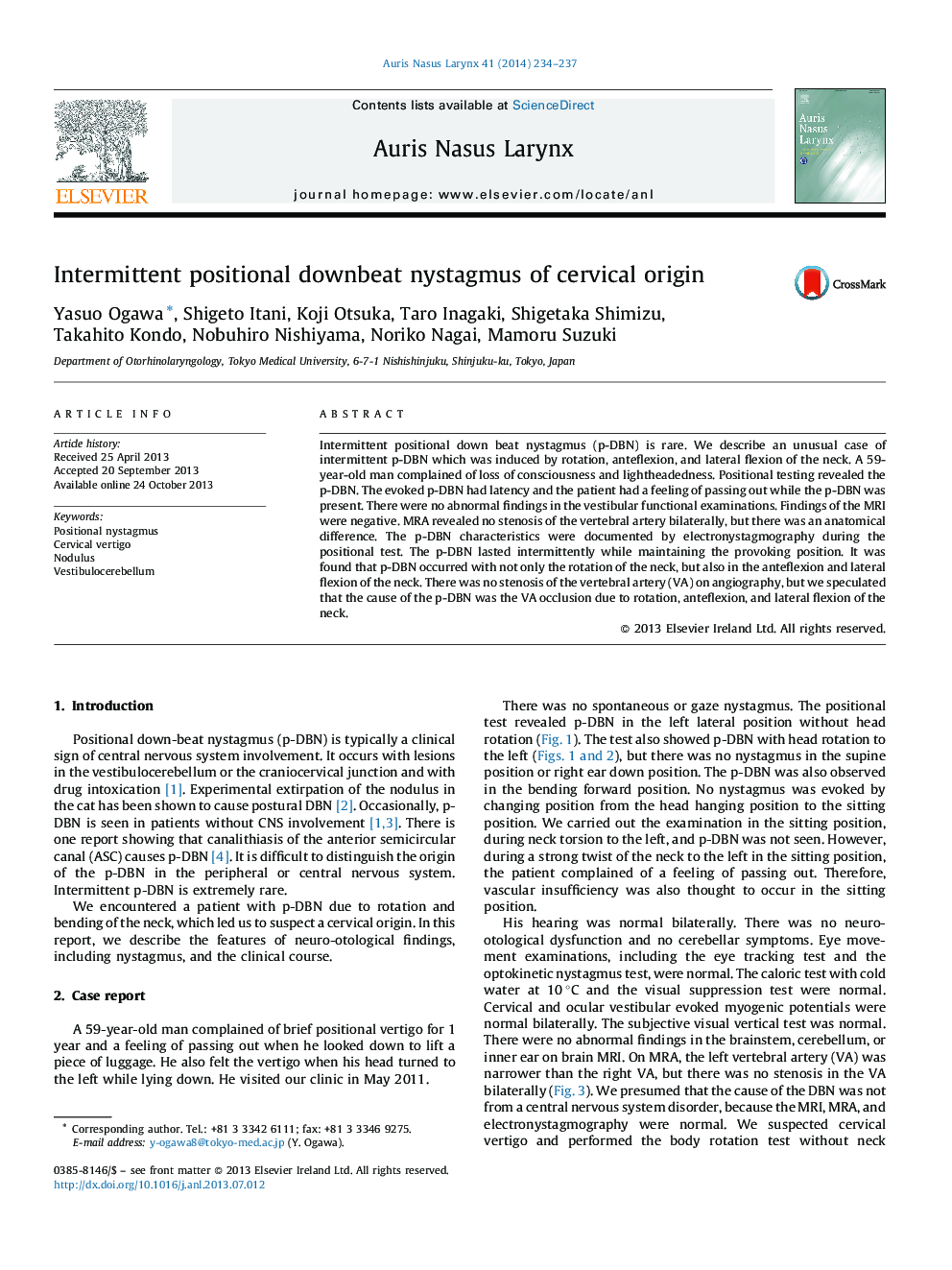 Intermittent positional downbeat nystagmus of cervical origin