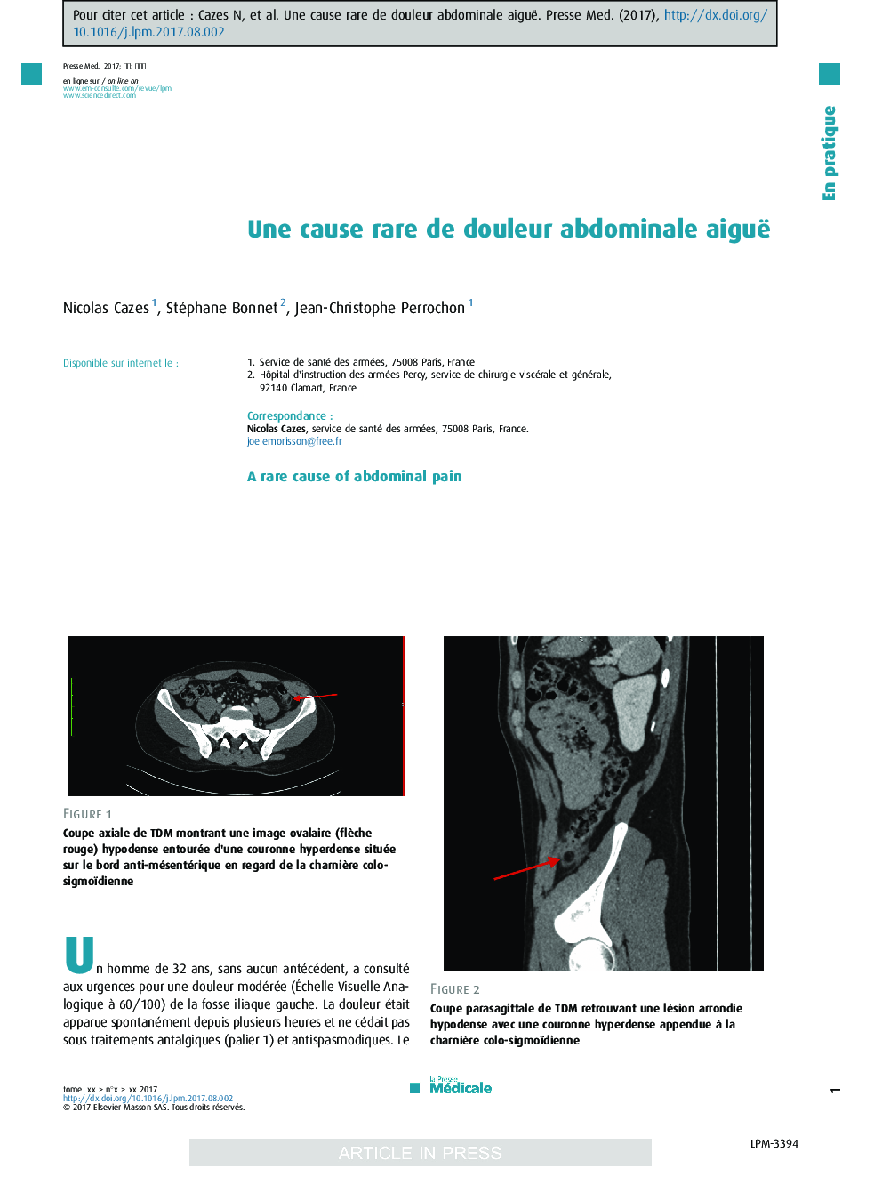 Une cause rare de douleur abdominale aiguë