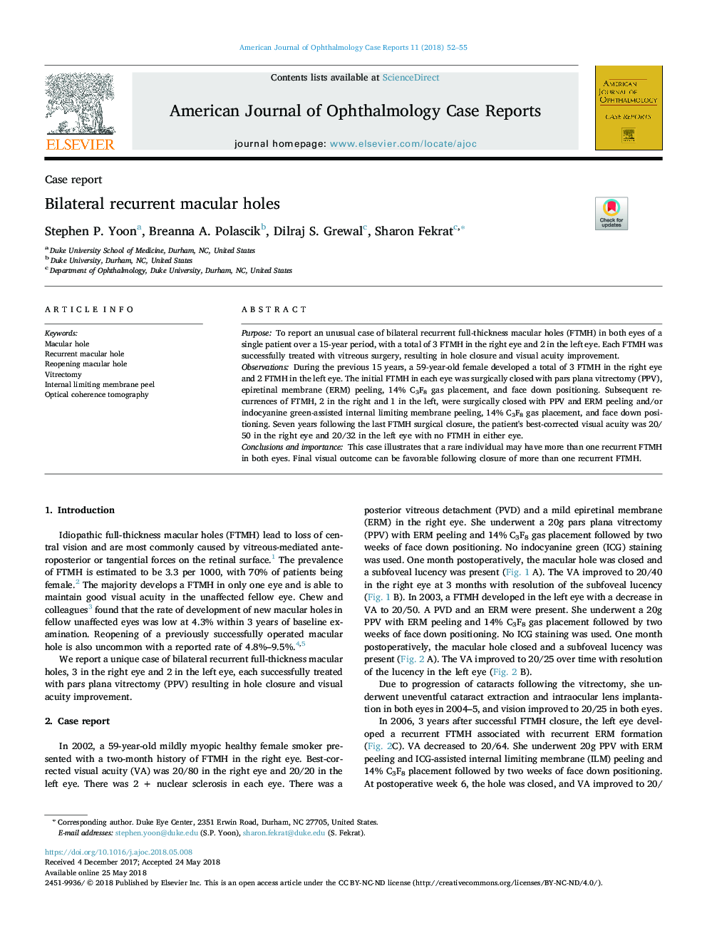 Bilateral recurrent macular holes