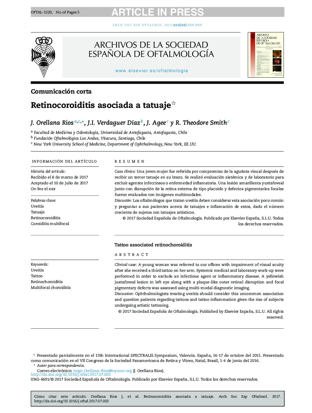 Retinocoroiditis asociada a tatuaje