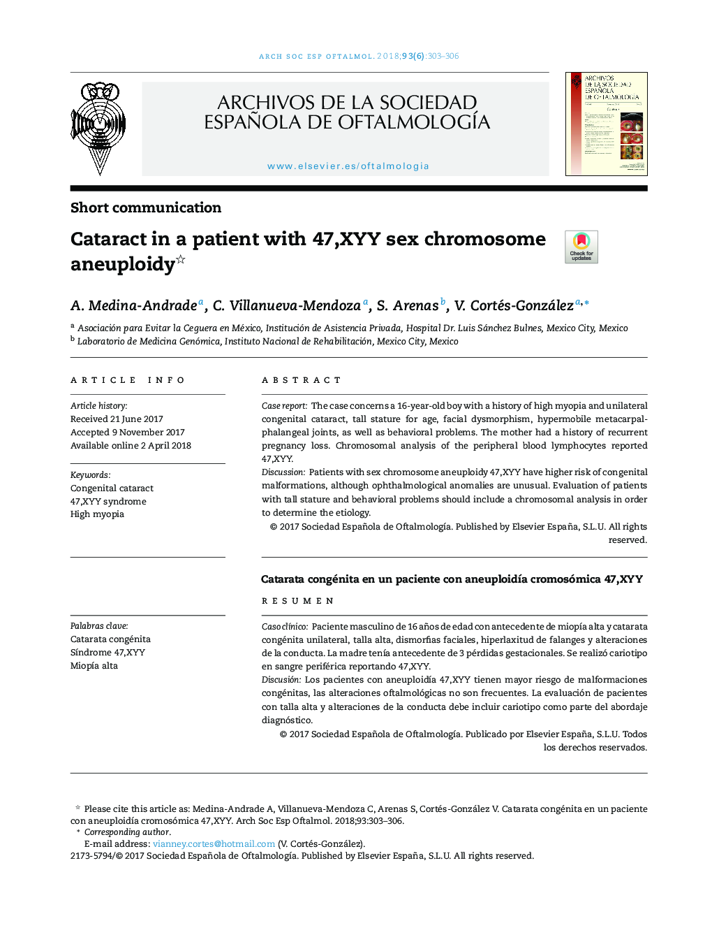 Cataract in a patient with 47,XYY sex chromosome aneuploidy