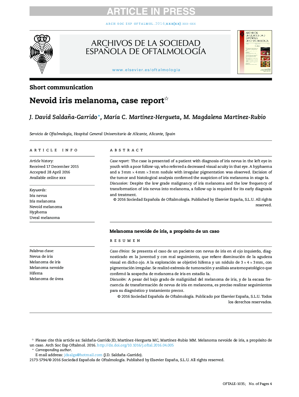 Nevoid iris melanoma, case report