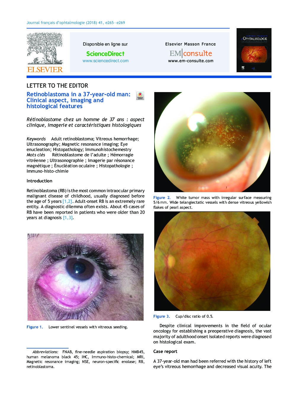 Retinoblastoma in a 37-year-old man: Clinical aspect, imaging and histological features