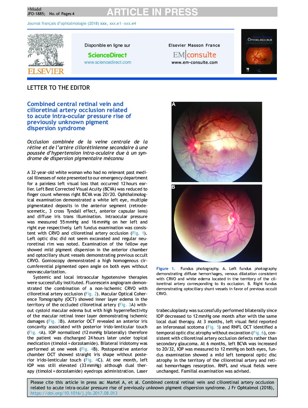 Combined central retinal vein and cilioretinal artery occlusion related to acute intra-ocular pressure rise of previously unknown pigment dispersion syndrome