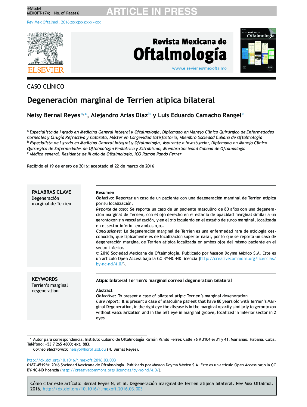 Degeneración marginal de Terrien atÃ­pica bilateral